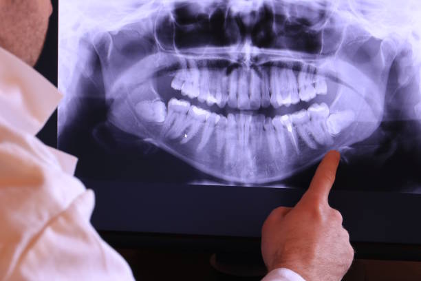 Best Pediatric Emergency Dentist in West Dundee, IL