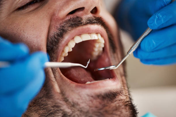 Best Emergency Denture Repair in West Dundee, IL